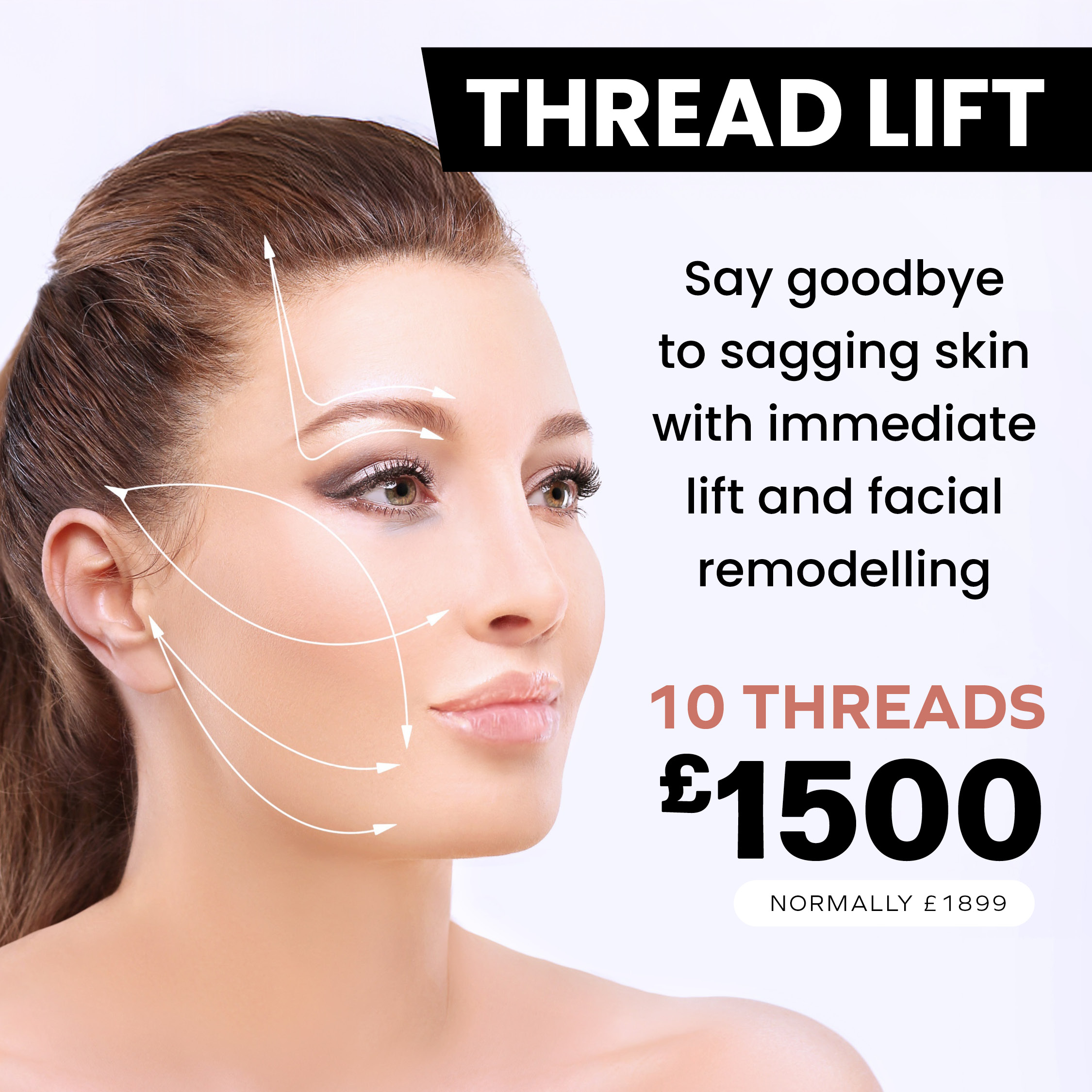Threadlift with 10 threads £1500